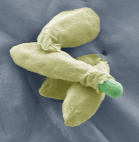 New insights into Clostridium spores suggests control strategy