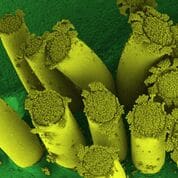 Forgotten stem rust harboured in barberry