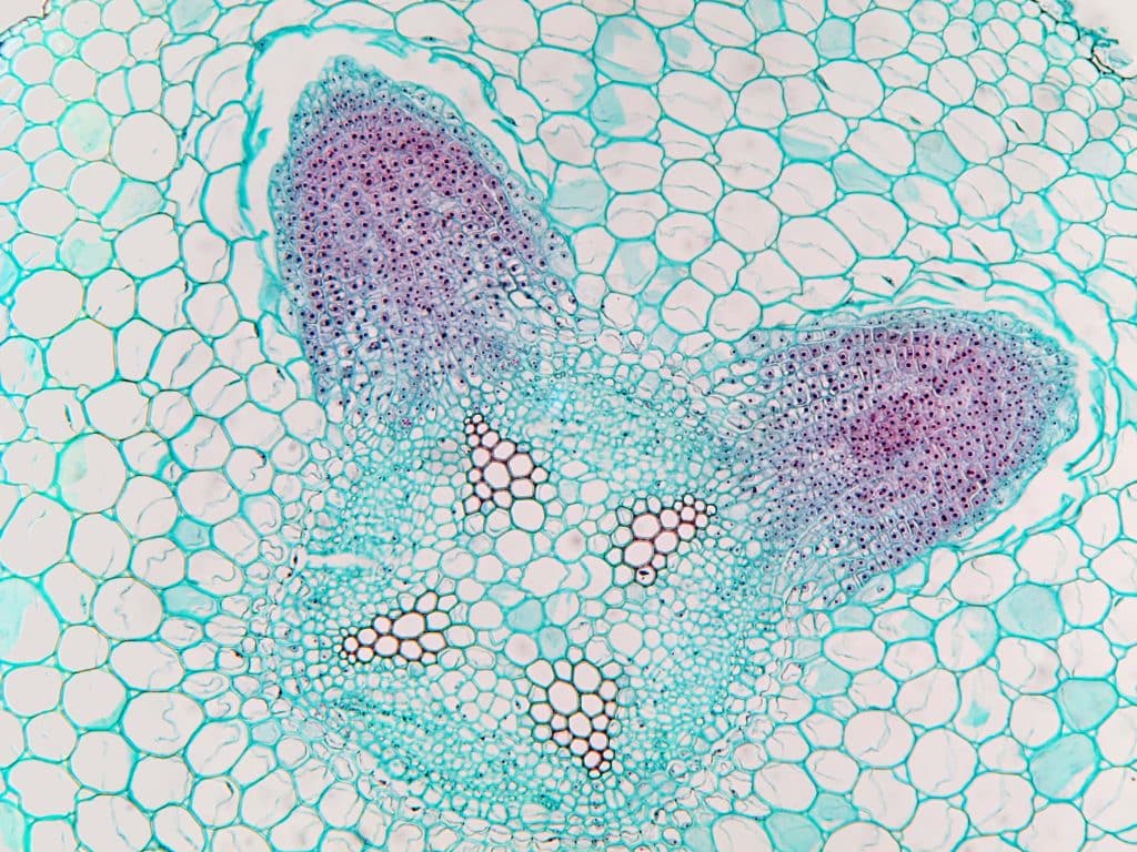 Cross section micrograph of a soybean (Glycine max) root showing developing root nodule. Magnification 100x shutterstock_146671826